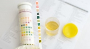 can i smoke before i give urine for analysis